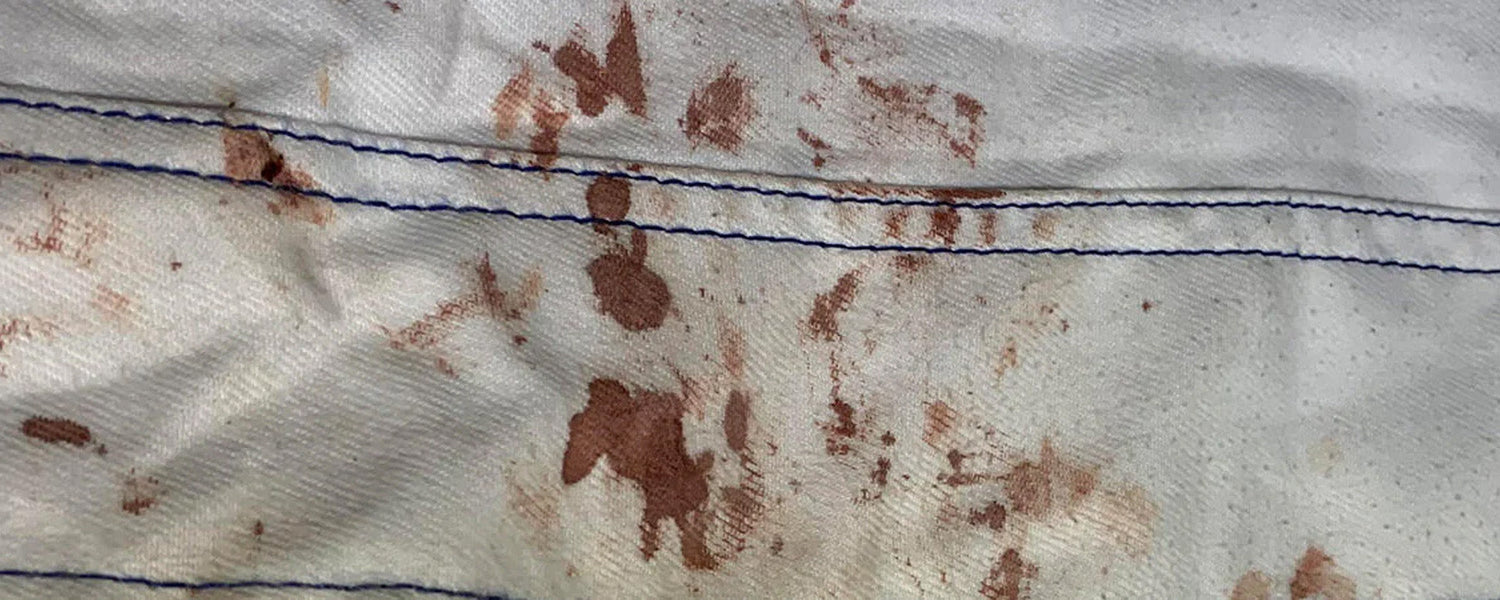 How to Get Blood Stains Out of BJJ Gi